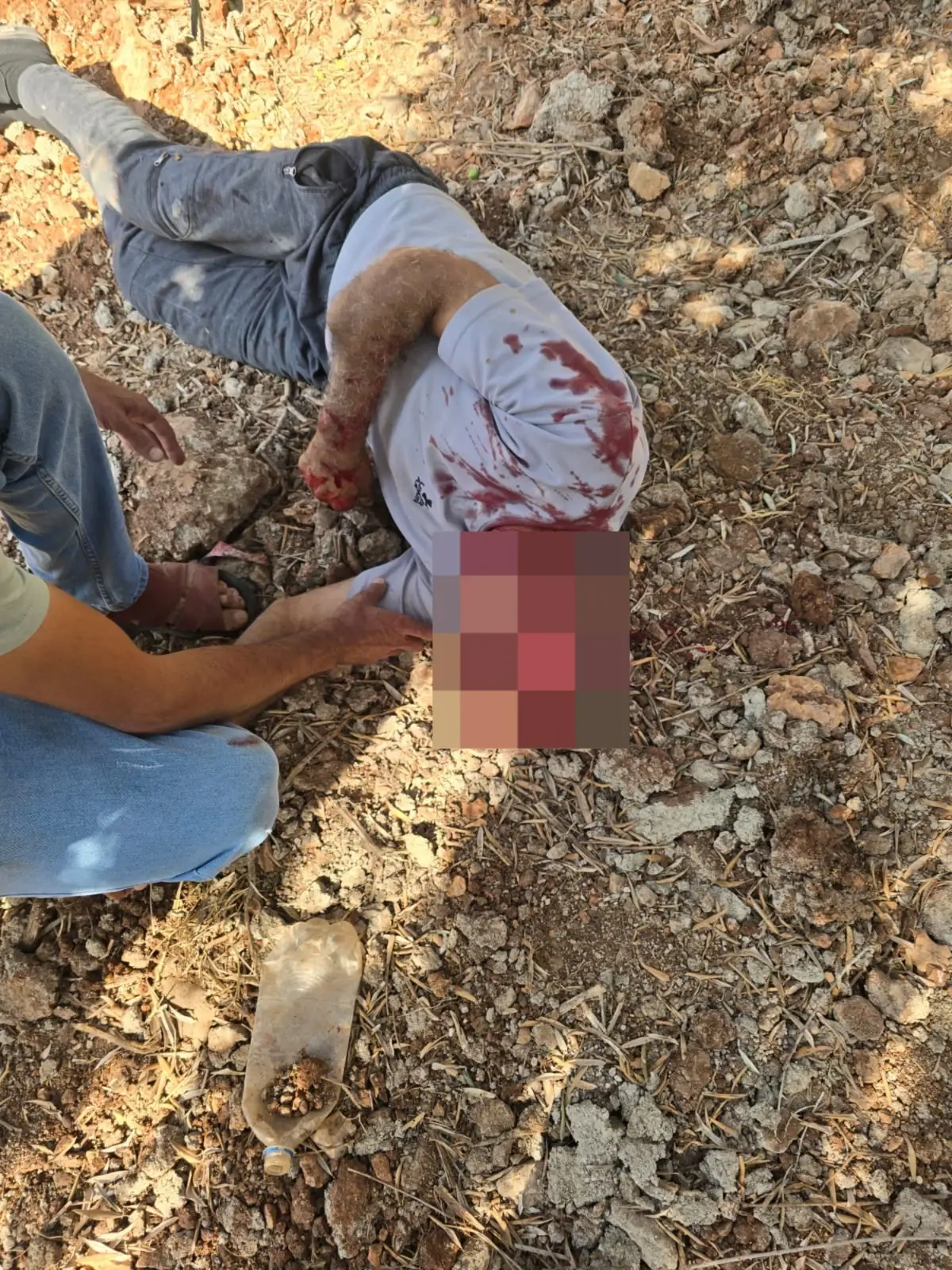 פצוע פלסטיני באוסרין פצוע פלסטיני באוסרין