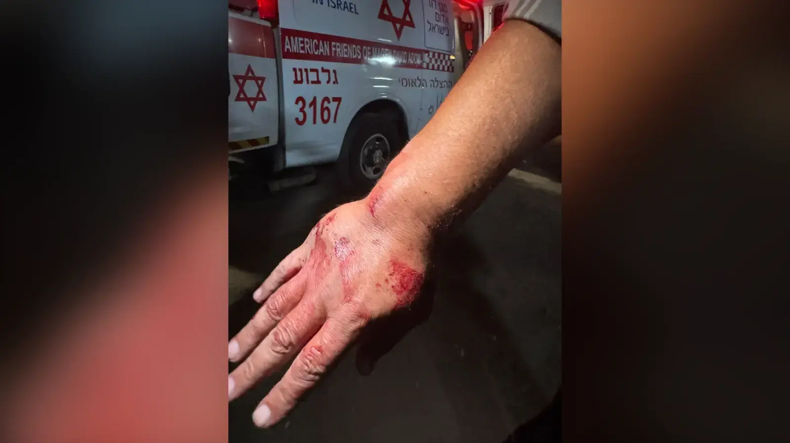 כף היד השבורה של הקורבן