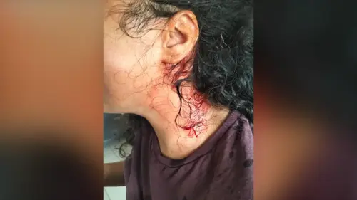 הנערה שהותקפה באוטובוס בבית שמש תשוב ללימודים