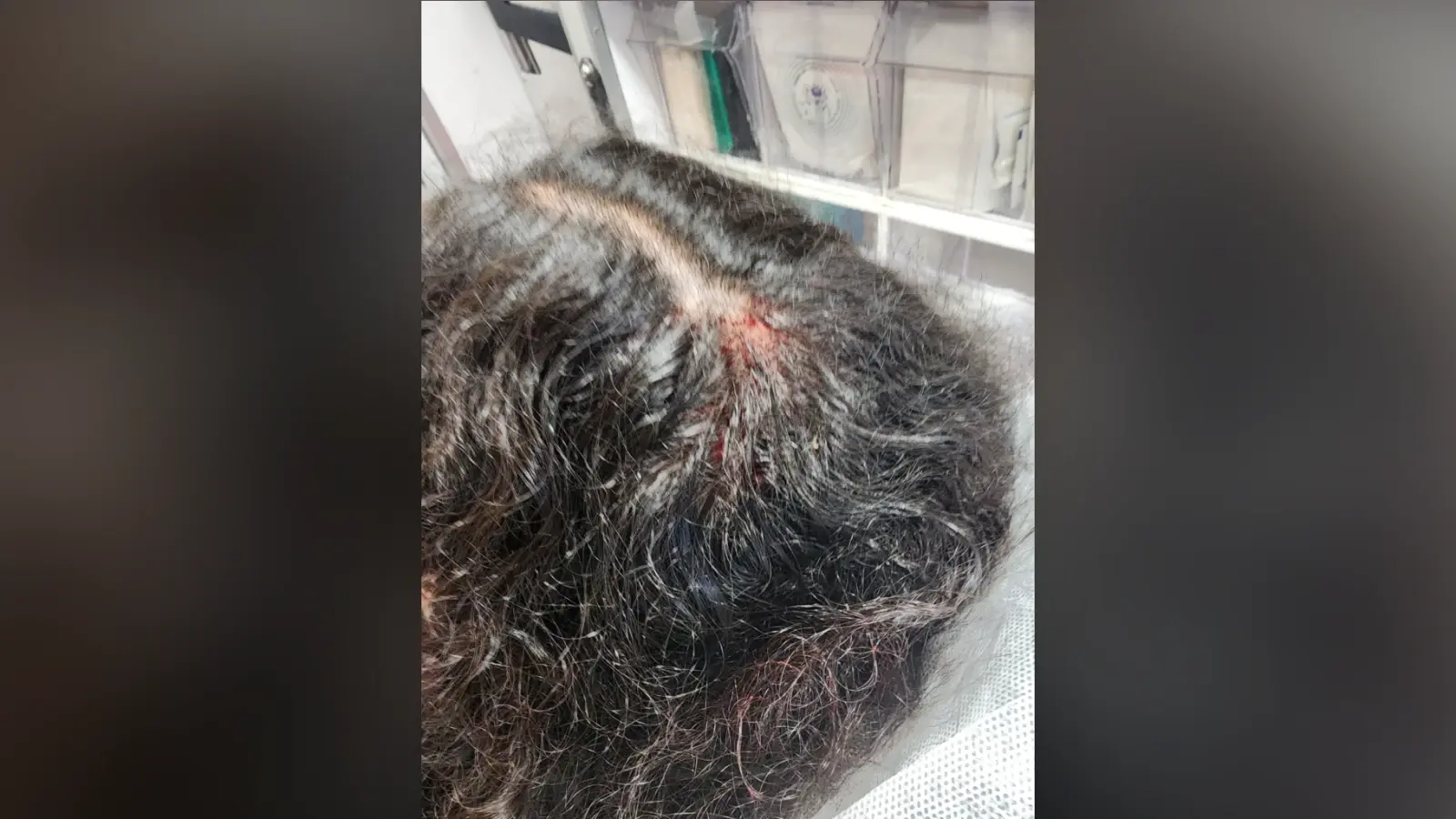 בת ה-16 מבית שמש שחזרה מבית הספר והותקפה באוטובוס