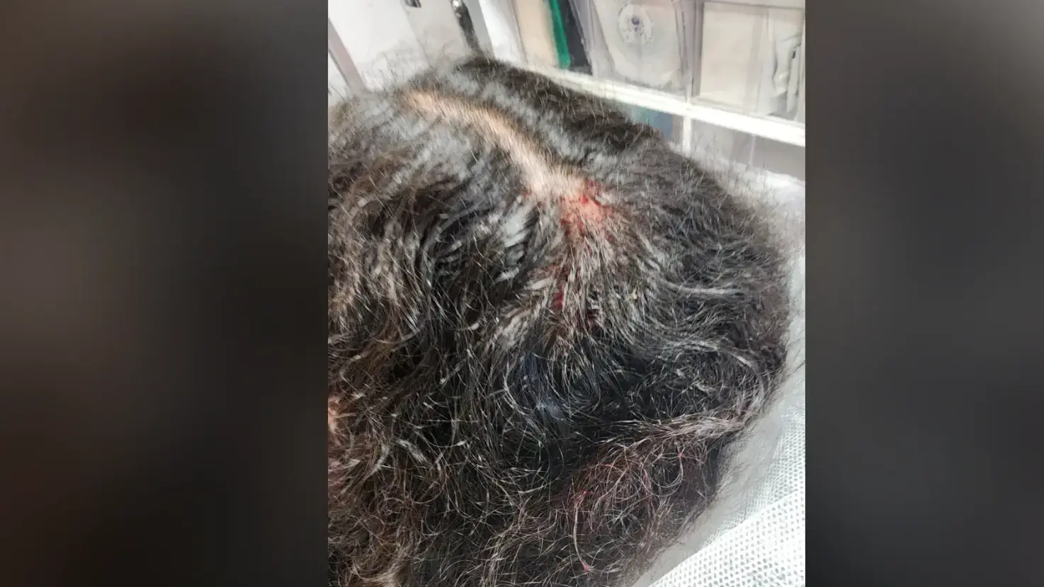 בת ה-16 מבית שמש שחזרה מבית הספר והותקפה באוטובוס בת ה-16 מבית שמש שחזרה מבית הספר והותקפה באוטובוס