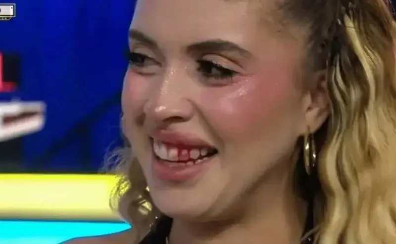 הדוגמנית חזרה לאולפן, כשסימני הפגיעה עדיין ניכרים בפניה הדוגמנית חזרה לאולפן, כשסימני הפגיעה עדיין ניכרים בפניה