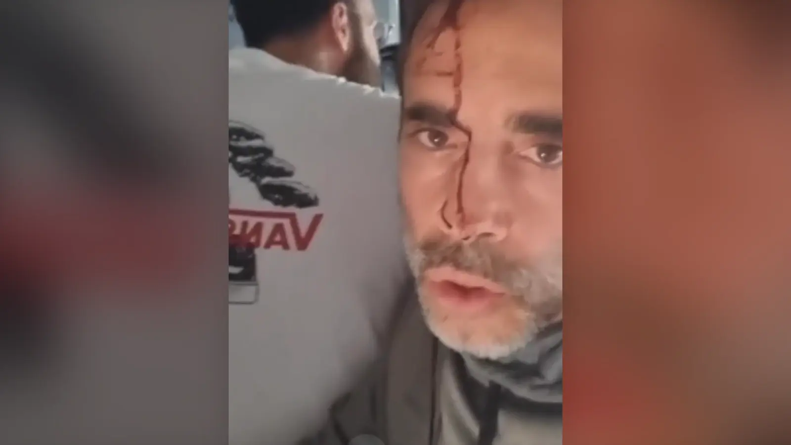 נוסעים מוכתמים בדם, טיסה מדובאי לתל אביב שעצרה בסעודיה נוסעים מוכתמים בדם, טיסה מדובאי לתל אביב שעצרה בסעודיה